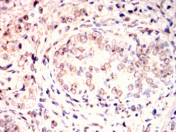 BLNK Antibody