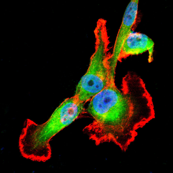SQSTM1 Rabbit Polyclonal Antibody