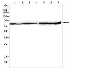 SQSTM1 Rabbit Polyclonal Antibody