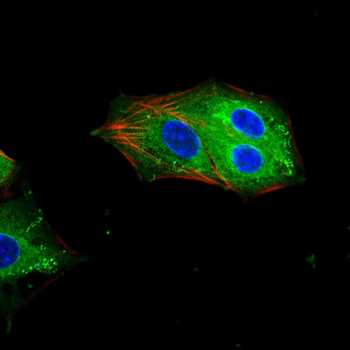 GABBR2 Antibody