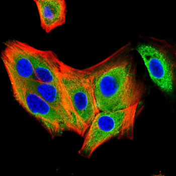 SQSTM1 Antibody