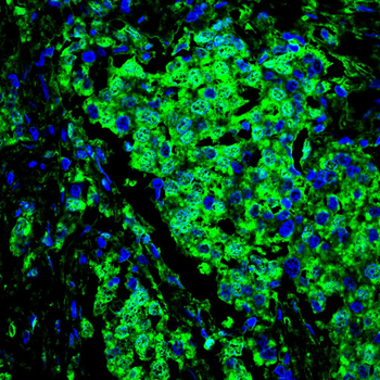 SQSTM1 Antibody