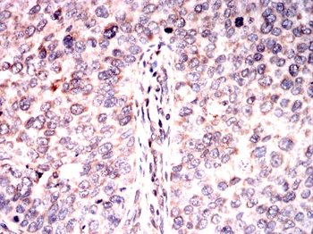 SQSTM1 Antibody