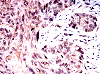 SQSTM1 Antibody