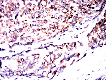 CFLAR Antibody