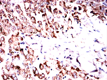 CFLAR Antibody