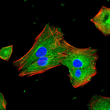 GABBR2 Antibody