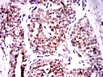CBL Antibody