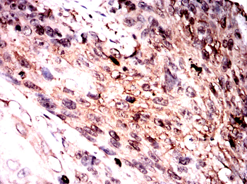 SFTPC Antibody