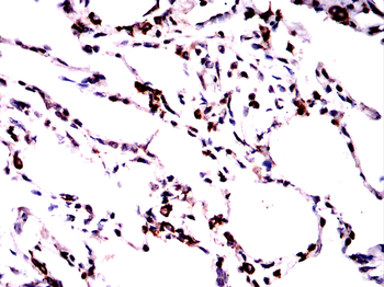 SFTPC Antibody