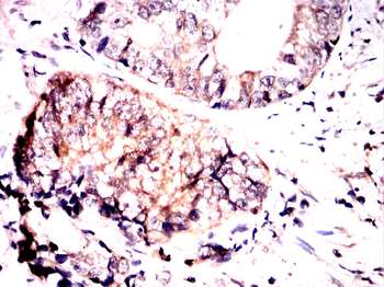 ABCC4 Antibody