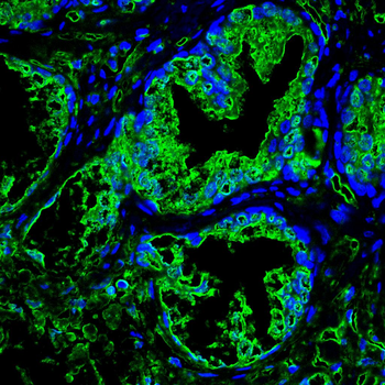 ABCC4 Antibody