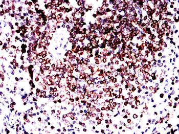 CD74 Antibody