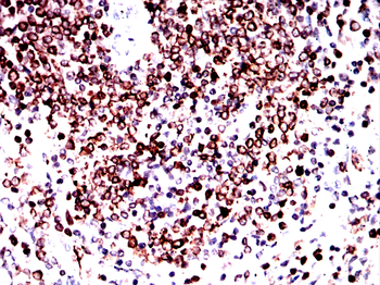 CD74 Antibody