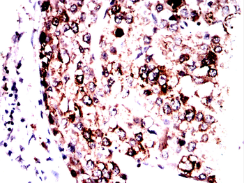 GPNMB Antibody