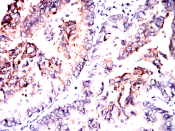 GPNMB Antibody