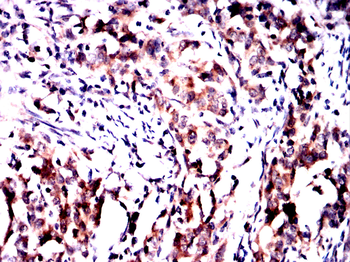 GPNMB Antibody