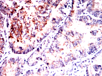 GPNMB Antibody