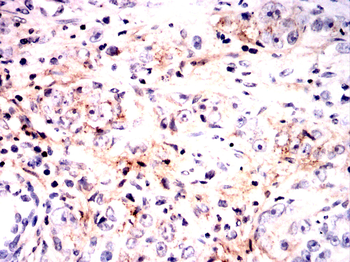 GPNMB Antibody
