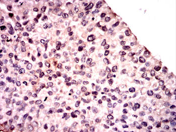 RING1 Antibody