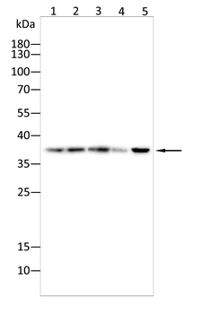 KLK3 Antibody