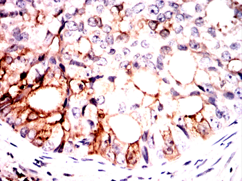 KLK3 Antibody