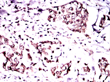 GCK Antibody