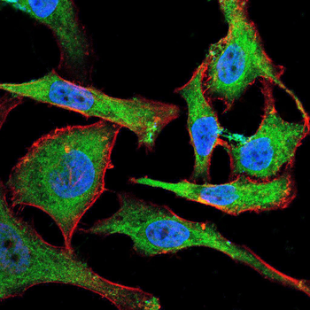 GCK Antibody