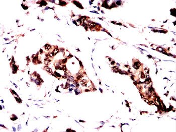 GAB2 Antibody