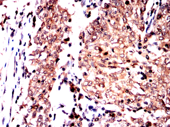 GAB2 Antibody