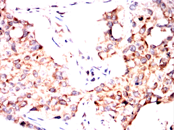 GAB2 Antibody