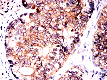GAB2 Antibody