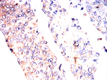 DAPK3 Antibody