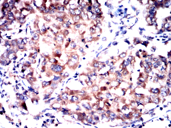 DAPK3 Antibody