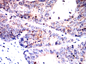 DAPK3 Antibody