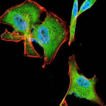 DAPK3 Antibody