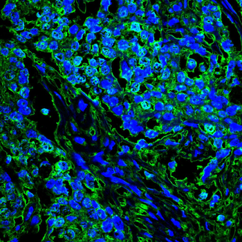 DAPK3 Antibody