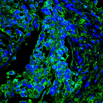 DAPK3 Antibody
