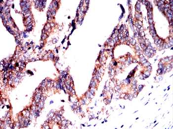 DAPK3 Antibody