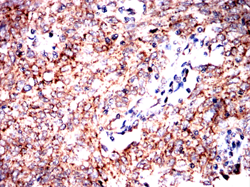 DAPK3 Antibody