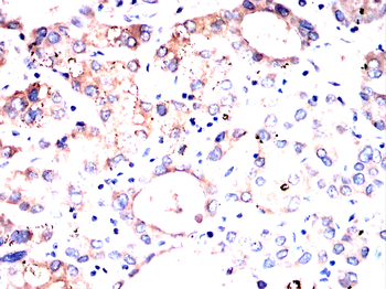 PRL Antibody