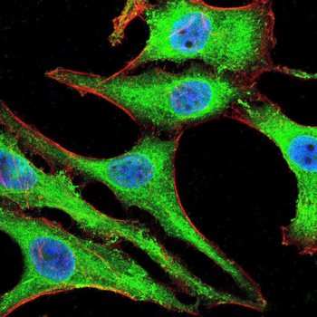 RANBP9 Antibody