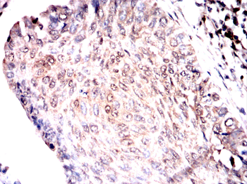 RANBP9 Antibody