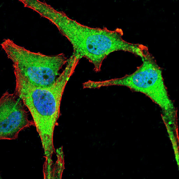 PDK2 Antibody