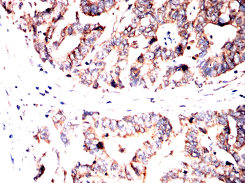 RAB27A Antibody
