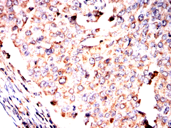RANGAP1 Antibody