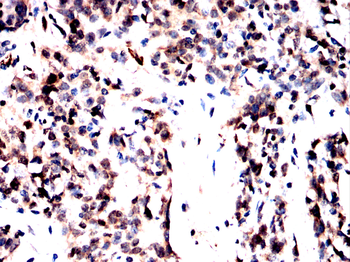 ADD1 Antibody