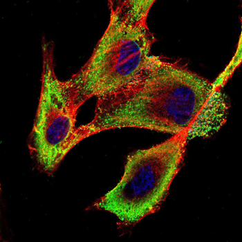 IRAK3 Antibody