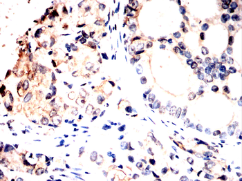 IRAK3 Antibody