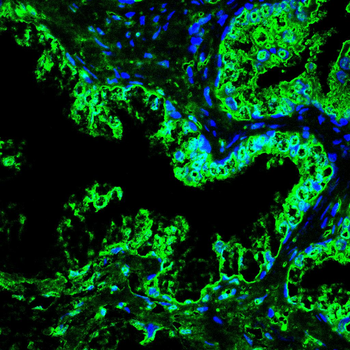 IRAK3 Antibody
